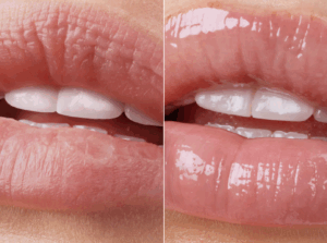 Gisou Honey Glaze Collagen Therapy Lip Mask